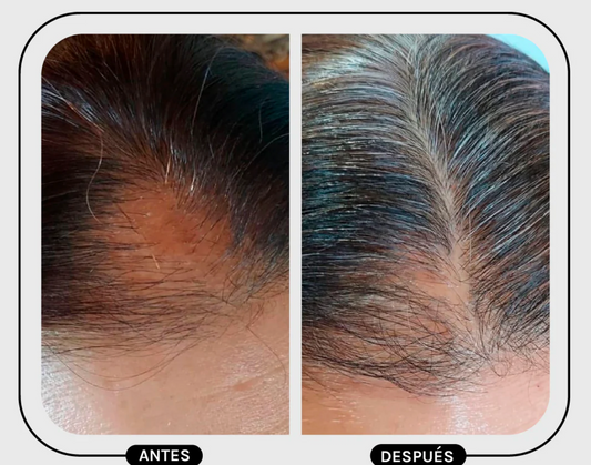 TÓNICO CAPILAR DIURNO REVITALIZANTE 60ML Magic Hair